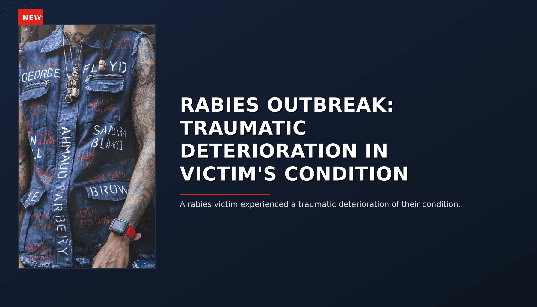 NEWS: RABIES OUTBREAK: TRAUMATIC DETERIORATION IN VICTIM'S CONDITION — VPNews